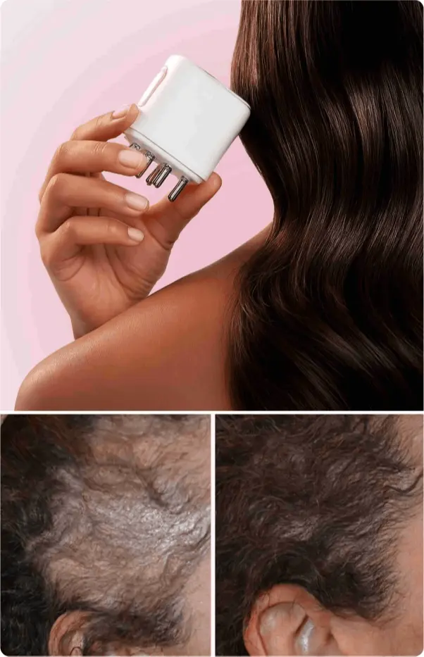 What is HairLux